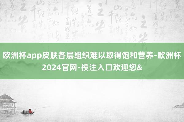 欧洲杯app皮肤各层组织难以取得饱和营养-欧洲杯2024官网-投注入口欢迎您&