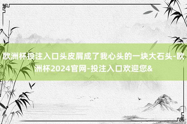 欧洲杯投注入口头皮屑成了我心头的一块大石头-欧洲杯2024官网-投注入口欢迎您&